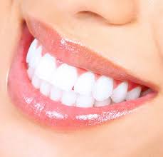 Teeth Whitening in Rohini Sector 15